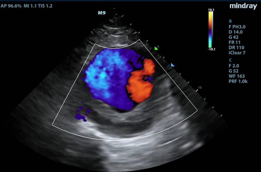 Fetal Color Doppler | Iqramed