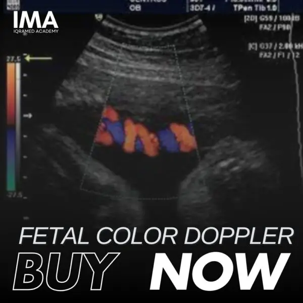 Fetal Color Doppler