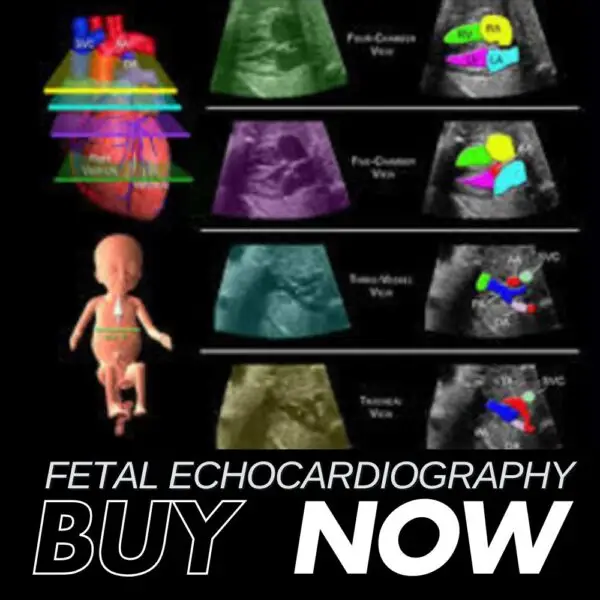 Fetal Echocardiography