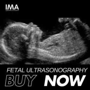 Fetal Ultrasound