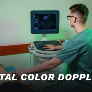 Fetal Color Dopler