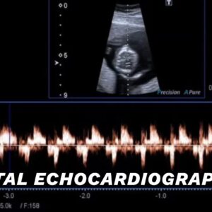 Fetal Echocardiography