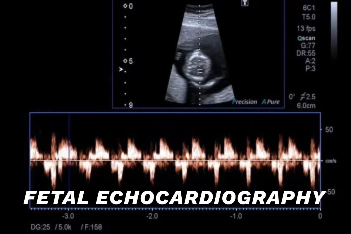 Fetal Echocardiography