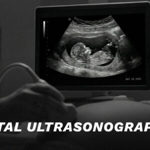 Fetal Ultrasound