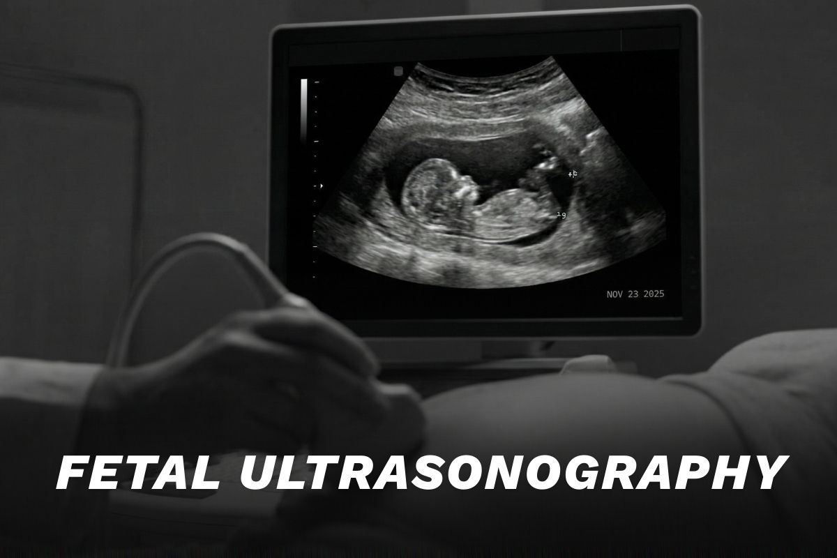 Fetal Ultrasound