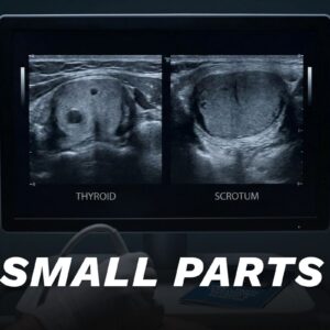 Small Parts and Thyroid Scan